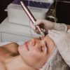 Microneedling : le soin qui réveille naturellement l’éclat de la peau